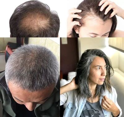 洗頭水中撒一把，頭發(fā)長得又快又茂密，白發(fā)都沒了！